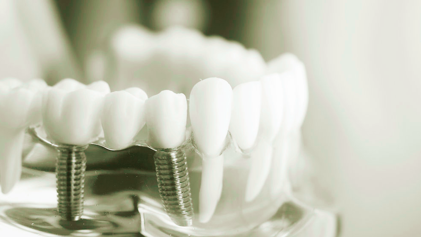 O Sorriso que Você Precisa em um Único Dia